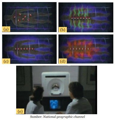 teknologi kemagnetan MRI